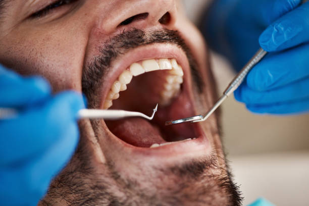 Best Emergency Gum Treatment in Marmora, NJ
